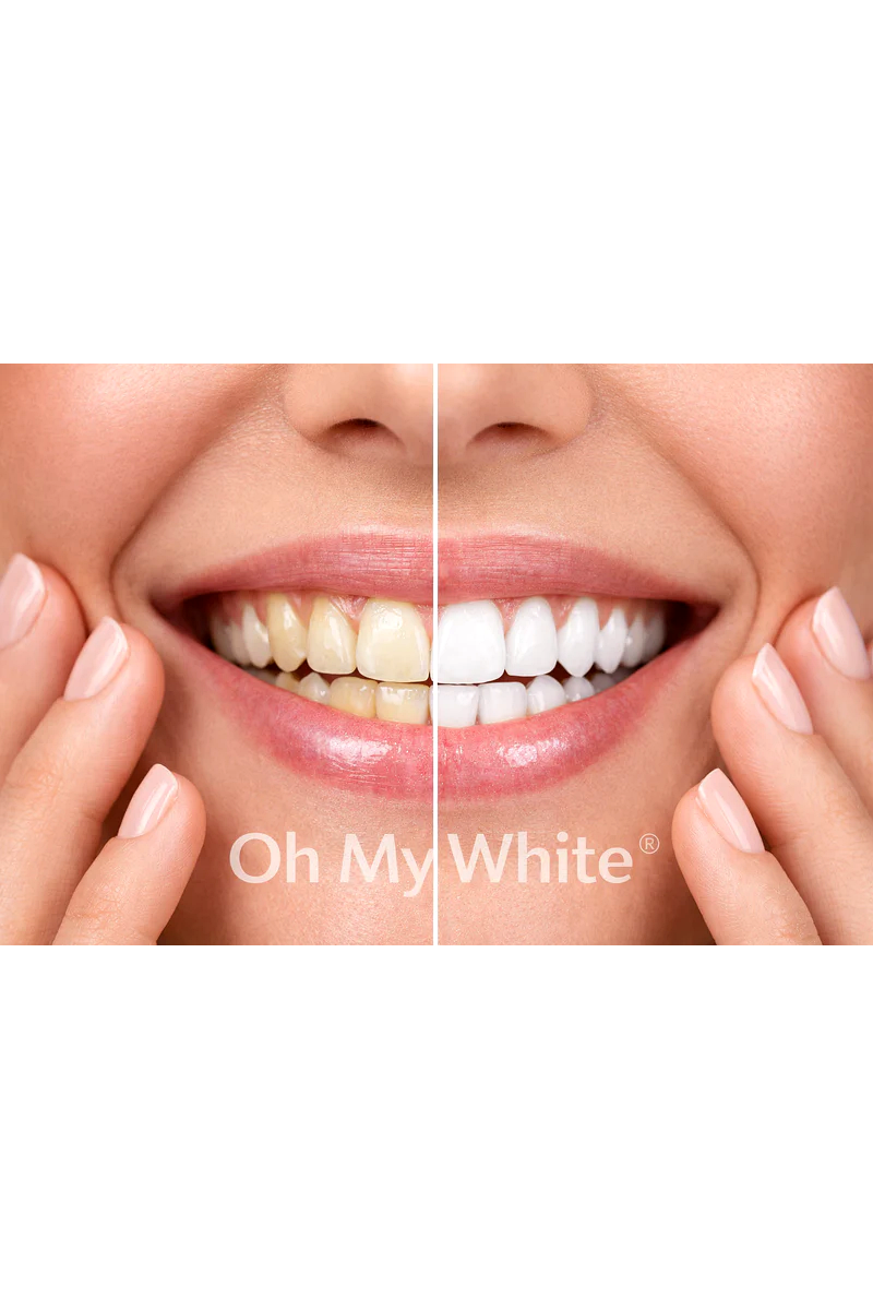 Oh My White™ – Poudre Correctrice de Couleur Dents Instantané